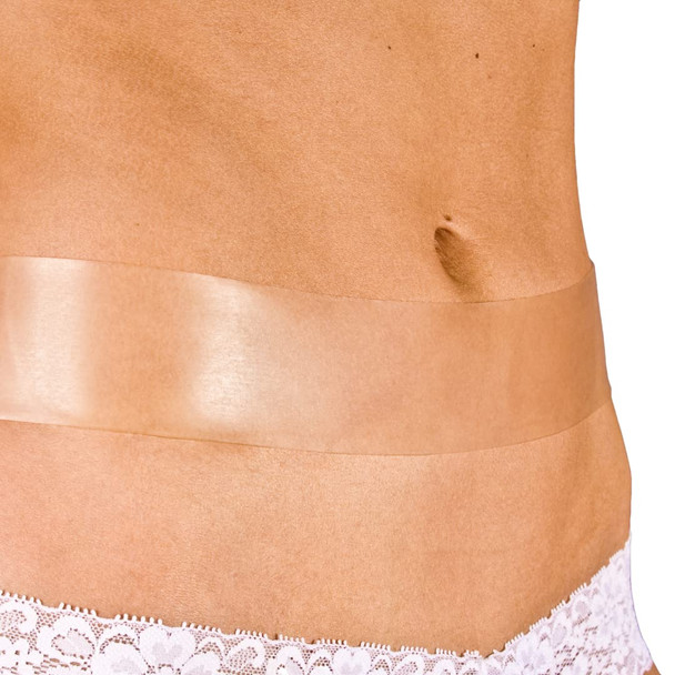 Newgel+ Advanced Silicone Professional Scar Treatment Tape For Abdomen And Extremity, Post Surgery, C-Section, Injury, Keloids, Burns, Reusable, 2" X 18" Strip - Clear