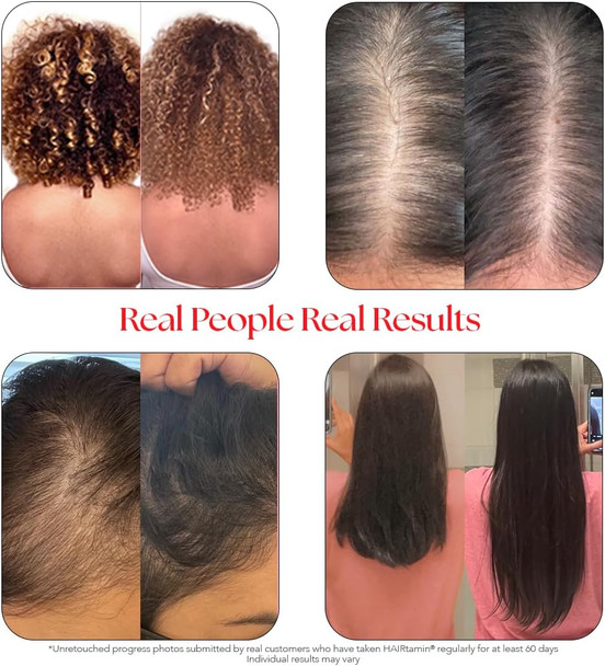Hairtamin Advanced Hair & Scalp Serum Pack  All-Natural Vegan Biotin Capsules & Serum Sample For Hair, Skin & Nail Growth
