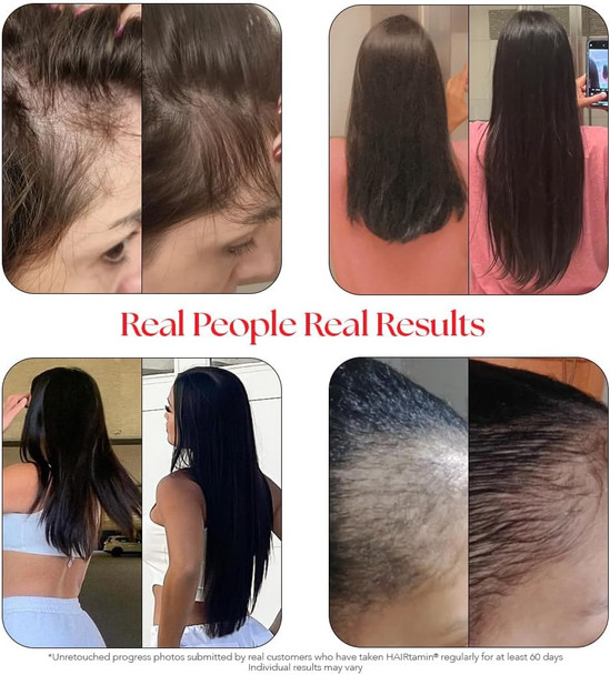 Hairtamin Vegan Gummy Stars Hair Vitamins  Non-Gmo  All Natural Biotin Hair Vitamin Gummies To Maintain Healthy Hair Skin & Nails  Multivitamin Supplement