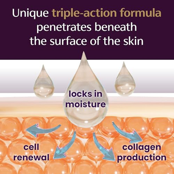 Mederma Pm Intensive Overnight Scar Cream, Works With Skin'S Nighttime Regenerative Activity, Clinically Shown To Make Scars Smaller And Less Visible, 1.0 Oz (28G)