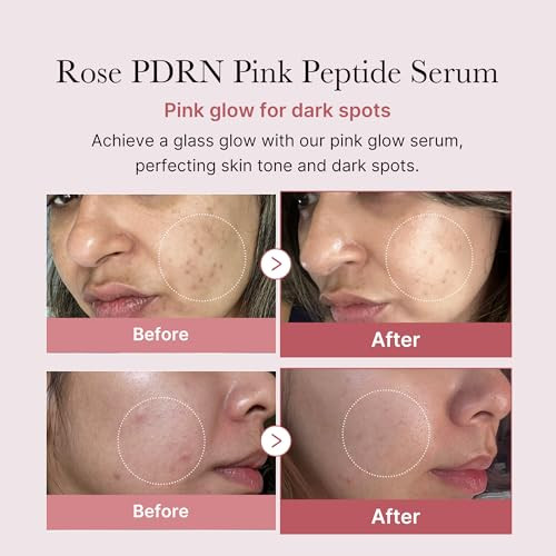 Medicube Holiyday Gifts Rose Pdrn Pink Trio Set : Medicube Pdrn Pink Peptide Serum & Toner & Jelly Gel Mask (1 Count (Pack Of 4)) I Stocking Stuffers For Women, Gifts For Her