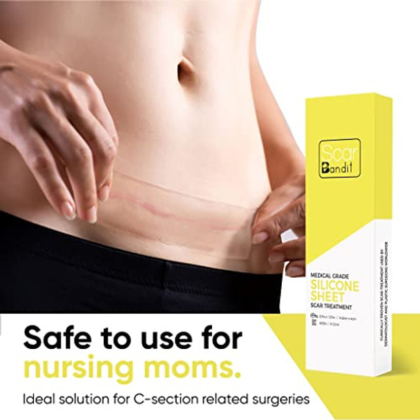 Scarbandit Silicone Scar Sheets – 4Pcs Clear Premium Scar Treatment Tape, Surgical, Acne Scar, Keloid, Burn & Stretch Mark Remover - 5.91 In X 1.18 In Must-Have For Tummy Tuck And C-Section Recovery