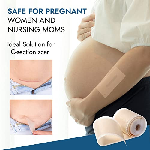 Scarbandit Silicone Scar Sheets, Tape, Patch, Strips - Scars Removal Treatment - Keloid Bump, Tummy Tuck & C-Section Recovery Must Have - (59In 0.025Cm)