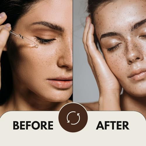 24K Gold Foil Essence Serum With Rose Extract, Moisturizing Anti-Aging Anti Acne Treatment Essence Cream, Face Skin Gold Essence Serum 1 Fl Oz, 30 Ml