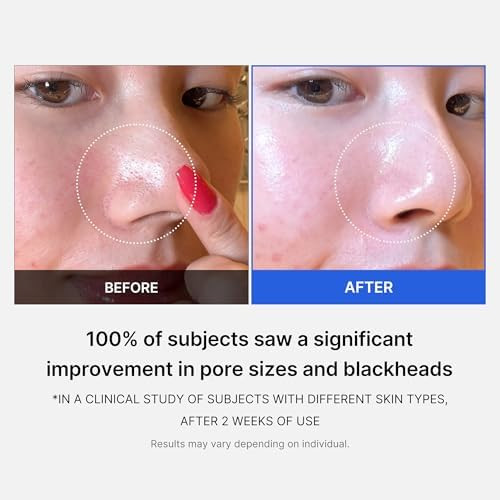Medicube Daily Toner Pads With Exosome 7500 For Pore Care: Medicube Zero Pore Pads 2.0 And Zero Exosome Shot 7,500 Ppm Spicule Facial Serum