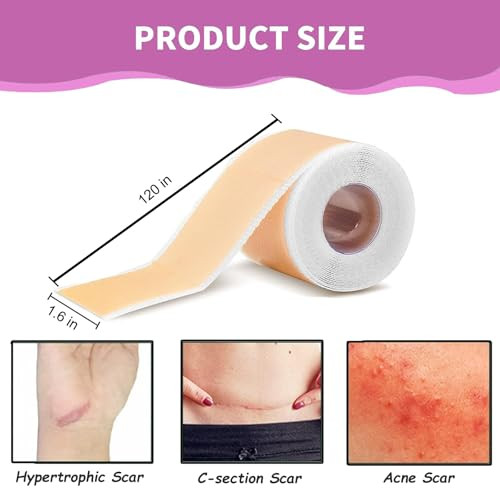 Silicone Scar Tape,Silicone Scar Sheets Roll,Soft Silicone Tape,Scar Tape For Surgical Scars,Reusable Scar Patch For C-Section, Keloids, Surgical 6.23M
