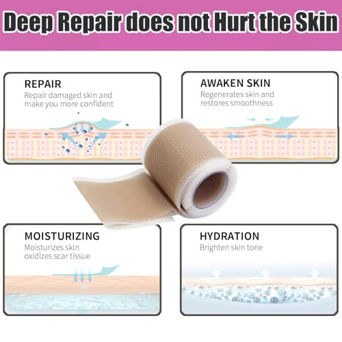 Silicone Scar Tape,Silicone Scar Sheets Roll,Soft Silicone Tape,Scar Tape For Surgical Scars,Reusable Scar Patch For C-Section, Keloids, Surgical 6.23M