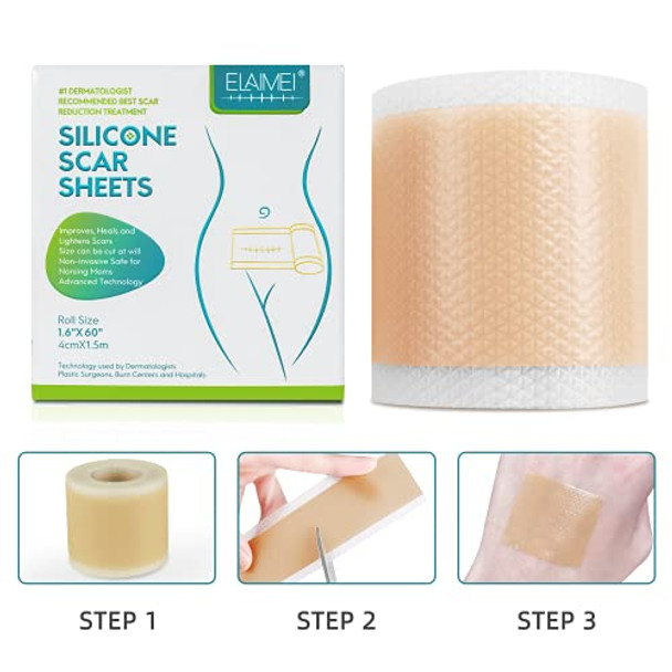Silicone Scar Sheets, Silicone Scar Tape Roll, Scar Silicone Strips, Scar Removal Sheet Long Strips For Acne Burn, Keloid (1.6” X 60”)