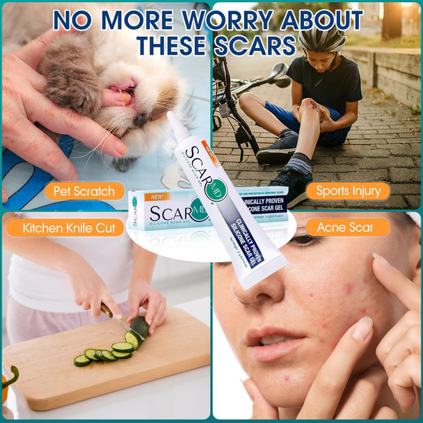 Scarmd Medical Grade Silicone Scar Gel Treatment,Keloid Bump Removal,Fades Scars From Surgery, Burn Scar,Face Belly Piercings, C Section, Cuts,Scratch,Scars Removal Treatment,Reduces Discomfort, 6G Scarmd Medical Grade Silicone Scar Gel Treatment,Keloid Bump Removal,Fades Scars From Surgery, Burn Scar,Face Belly Piercings, C Section, Cuts,Scratch,Scars Removal Treatment,Reduces Discomfort, 6G