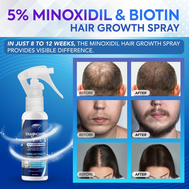 5% Minoxidil Hair Regrowth Spray - 60ml, For Men & Women