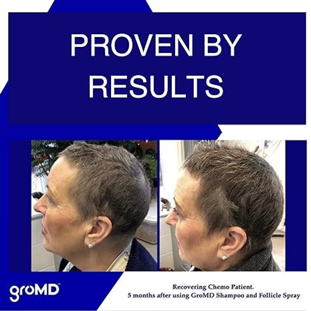 Hair Loss Serum, Hair Growth Treatment, Regrowth, Follicle Activator Spray, Argan Oil, Biotin & Caffeine, Thickening, Doctor Developed, DHT Blocking Ingredients, 60 Day Supply