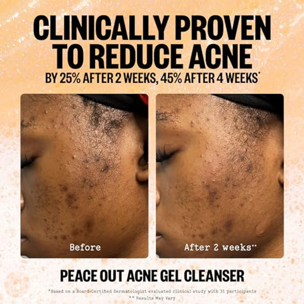 Peace Out Intense Defense Bundle Skincare Acne Gel Moisturizer And Get Cleanser Boost Skin Barrier And Help Dimishish Blemishes Daily Use For Men And Women