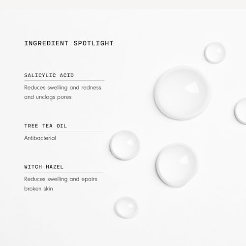 Versed Back-Up Acne Control Body Mist - All Over Blemish Spot Treatment + Salicylic Acid Spray With Tea Tree Oil & Witch Hazel - Oil Control + Redness Relief Acne Spray For Back & Body - Vegan (3 Oz)