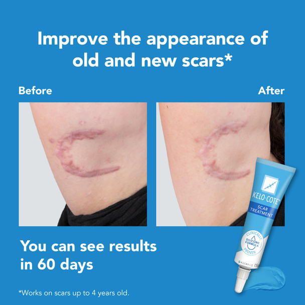 Kelo-Cotee 2 Pack Advanced Formula Scar Gel 15G