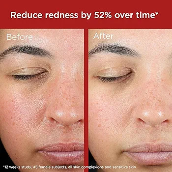 EltaMD UV Skin Recovery Face Sunscreen with Zinc Oxide All Mineral Safe for Sensitive Skin SPF 50Spf 50 (0.49 Oz) For Sensitive Skin With Zinc Oxide Protection Hypoallergenic 1.7 Oz