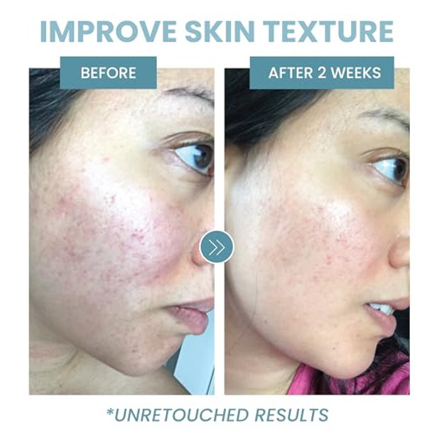 Collagen Peptide Serum Anti Aging Collagen Serum For Face Skin Brightening Reduces Fine Lines & Wrinkles Heals And Repairs Skin Microneedling Serum With Hyaluronic Acid (2 Oz)