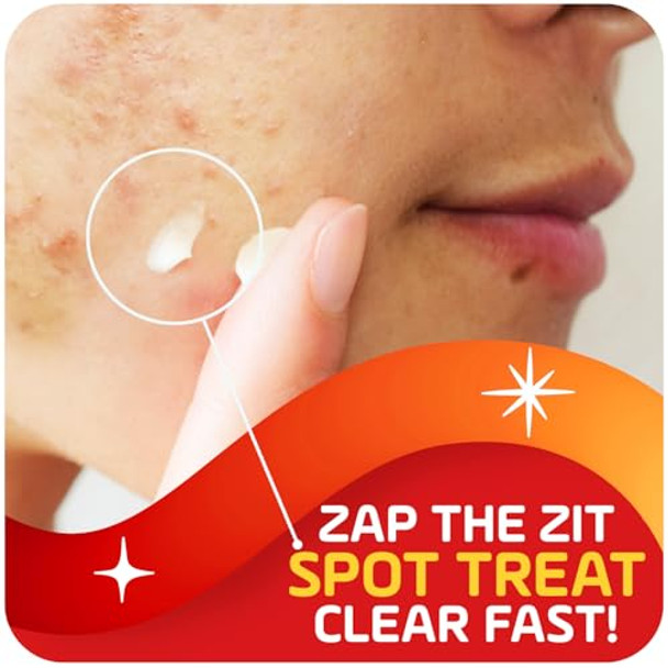 Asepxia Acne Treatment Cream For Face 2% Salicylic Acid Rapid Maximum Strength Acne Treatment Clears Pimples And Blackheads Prevents Acne And Controls Excess Oil 1 Oz Asepxia Acne Treatment Cream For Face 2% Salicylic Acid Rapid Maximum Strength Acne Treatment Clears Pimples And Blackheads Prevents Acne And Controls Excess Oil 1 Oz