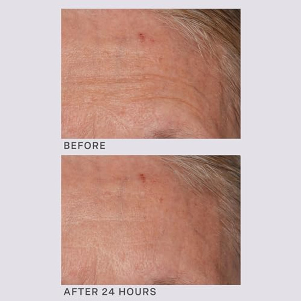 Lancer Gravity Defying Moisturizer With Firming Technology Face Moisturizer For Women Great At Boosting Collagen Hydration Antiaging And Firmness