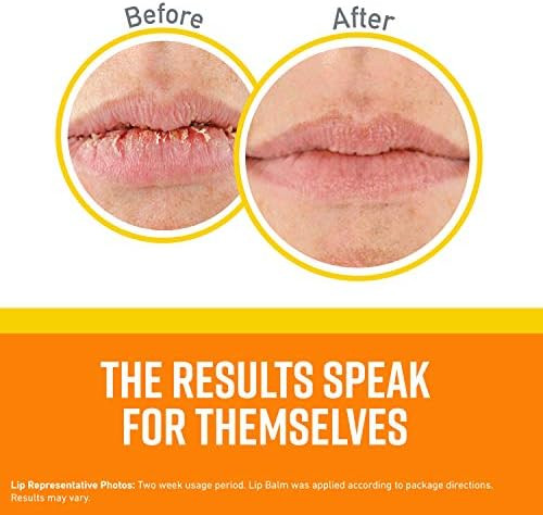 O'Keeffe'S Lip Repair Spf 35 Lip Balm (Pack Of 2)