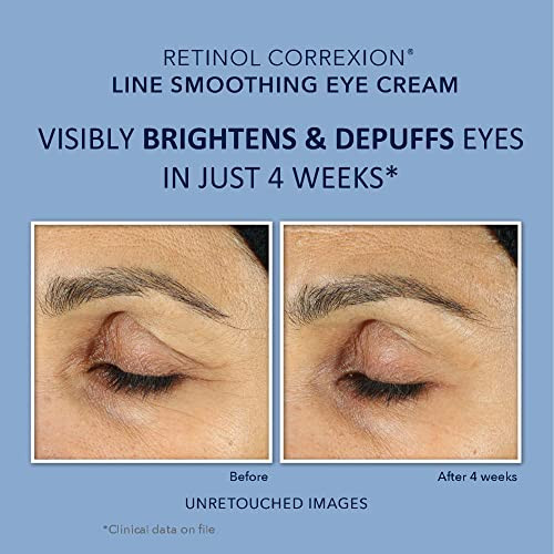 Roc Retinol Correxion Value Set Duo Deep Wrinkle Anti-Aging Night Face Cream + Daily Under Eye Cream For Dark Circles & Puffiness Skin Care Set (Packaging May Vary)