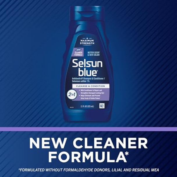 Selsun Blue 2-In-1 Anti-Dandruff Shampoo & Conditioner 11 Fl. Oz. Maximum Strength 2-In-1 Treatment Selenium Sulfide 1% (Pack Of 2)