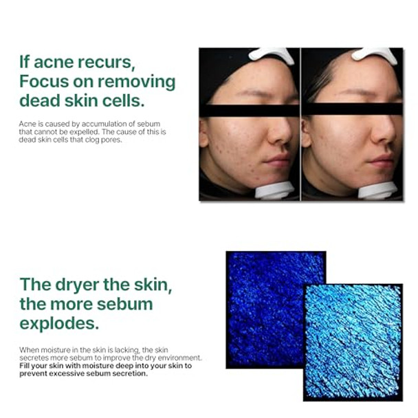 Some By Mi Aha Bha Pha 30 Days Miracle Toner + Bye Bye Blackhead 30 Days Miracle Green Tea Tox Bubble Cleanser