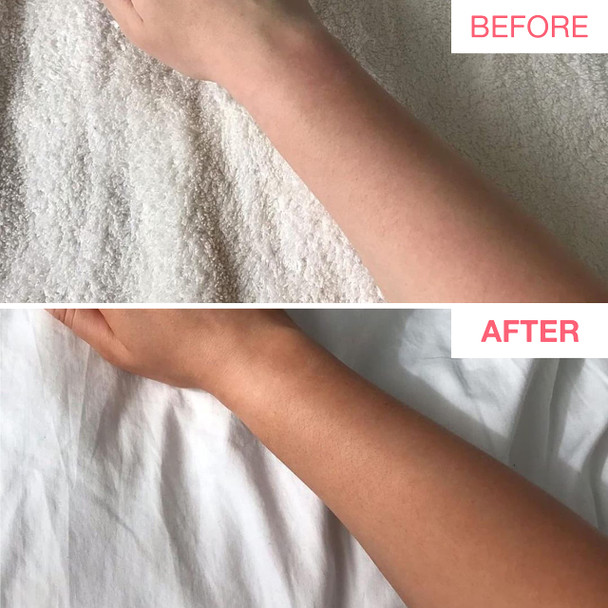 Bare by Vogue Self Tan Firming Lotion - Ultra Dark - Natural tanning Glow Moisturising Suitable for All Skin Types - Self Tanner for Face & Body Bare by Vogue Self Tan Firming Lotion - Ultra Dark - Natural tanning Glow Moisturising Suitable for All Skin Types - Self Tanner for Face & Body