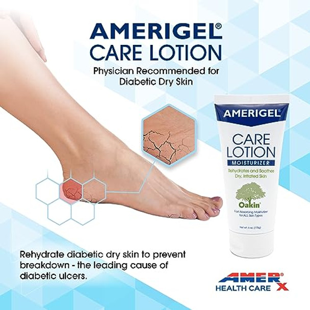 Amerigel Care Lotion – Hypoallergenic Moisturizer - Diabetic Skin Care - Rehydrates And Soothes Dry Irritated Skin - 6 Oz.