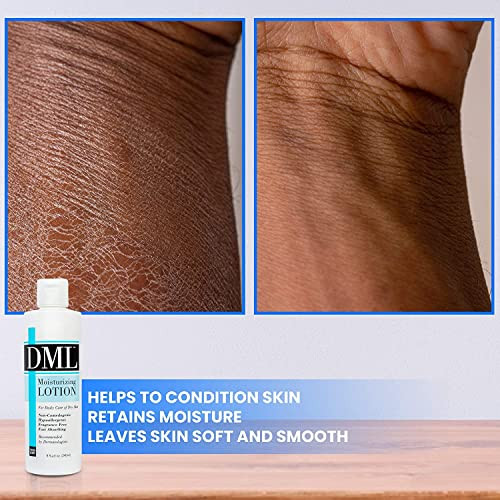 Dml Moisturizing Lotion 8 Oz (Pack Of 3)