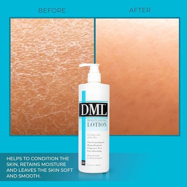 Dml Moisturizing Lotion For Dry Skin Fragrance - 16 Oz (Pack Of 3)