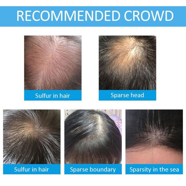 Hair Building Fibers For Thinning Hair With Spray Applicator Pump Nozzle - Natural & Undetectableinstantly Thicker Fuller Hair Conceals Hair Loss 30 Sec4 Shades For Men & Women27.5G (Black)