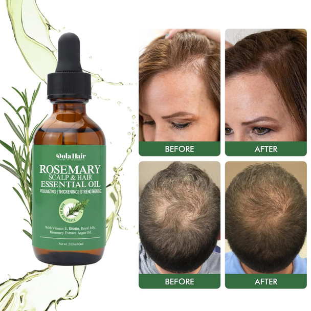 Organic Essential Rosemary Oil For Hair Growth Thin Hair Healthy Scalp And Skin (2.03 Oz)