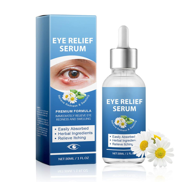 S_Tye Eye Treatment Natural Gentle Ingredient S_Tye Eye Drops Relief Serum For Cleanses Lashes And Eyes Safe & Effective Chalazion And Blepharitis Treatment 30Ml