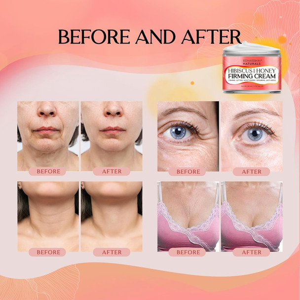 Enaskin Naturals Hibiscus & Honey Firming Cream: Moisturizer For Tightening Firming And Anti-Aging For Face Neck And Chest 1.7 Fl Oz