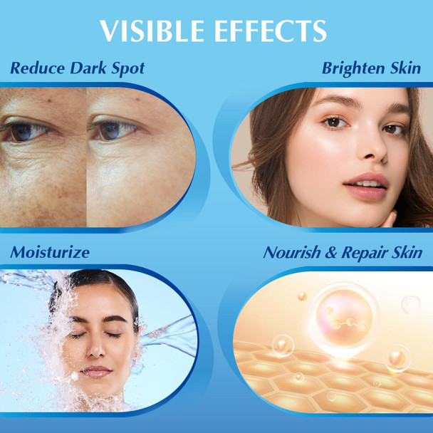 Enaskin Dark Spot Remover For Face: Hyperpigmentation Body Treatment For Freckles Melasma Age Spot Sun Spot - Dark Spots Corrector Serum For Women And Men (1.0 Fl Oz)