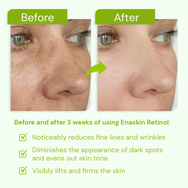 Enaskin Naturals Retinol Serum For Face: Anti-Wrinkle Filler For Deep Wrinkles Dark Spot & Neck Firming With Hyaluronic Acid 1 Fl Oz