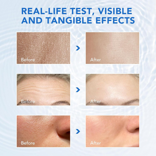 Wake Nature Perfection Hyaluronic Acid – Ultra Hydrating Serum For Smooth– Anti-Aging Formula With Hyaluronic Acid Tubes For Deep Moisture & Skin Rejuvenation – Pre-Makeup Hydration For All Skin Types