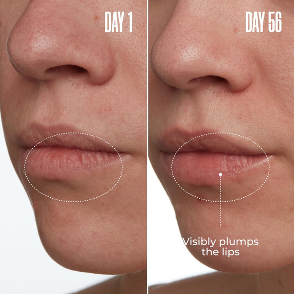Maëlys Cosmetics Too-Pouty Clinically Proven Lip Plumping Mask - Helps Reduce The Appearance Of Fine Lines - Contains Adeplump To Plump The Look Of Lips