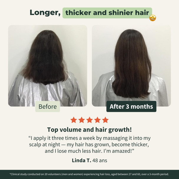 BIONOBLE Organic Rosemary Oil for Hair Growth - Slows Loss Restores Volume - Rosemary Hair Oil with Argan Jojoba & Castor Oil - 100% Natural & Vegan - Glass Bottle Dropper + Pump - 50ml