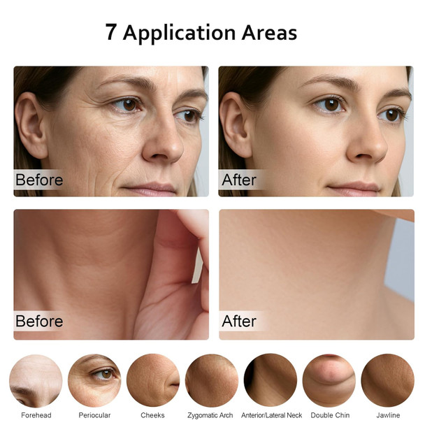 Keylitos 7 In 1 Multifunctional Facial Massager Red Light Therapy For Face Beauty Skin Care Tool For Face And Neck Portable Facial Massager For Wrinkles And Skin Care-White