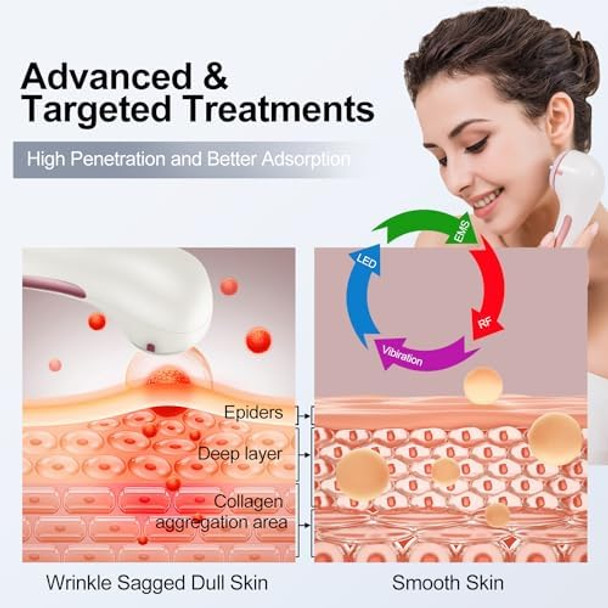 Mismon High Frequency Facial Machine Light Theraphy Micro-Current Device 5 In 1 Multifunctional Facial Massager For Face