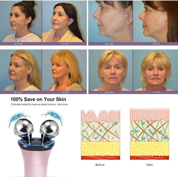 Yawpig Microcurrent Facial Device - Electric Face Lifting & Toning For Face & Neck For Mother & Companion - Handheld Skin Care Device (White)