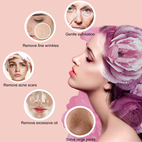 Diamond Microdermabrasion Machine Yofuly 65-68cmHg Suction Power Professional Dermabrasion Home Use Facial Skin Care Equipment 18 Piece Set Frost White