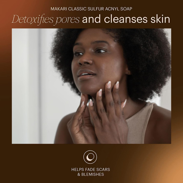 Makari Classic Acnyl Sulfur Soap (7 Oz)  Anti-Acne Bar Soap  Helps Fight Acne, Pimples, Whiteheads, And Blackheads  Detoxify Pores & Control Oil Production  Recommended For Oily & Acne-Prone Skin