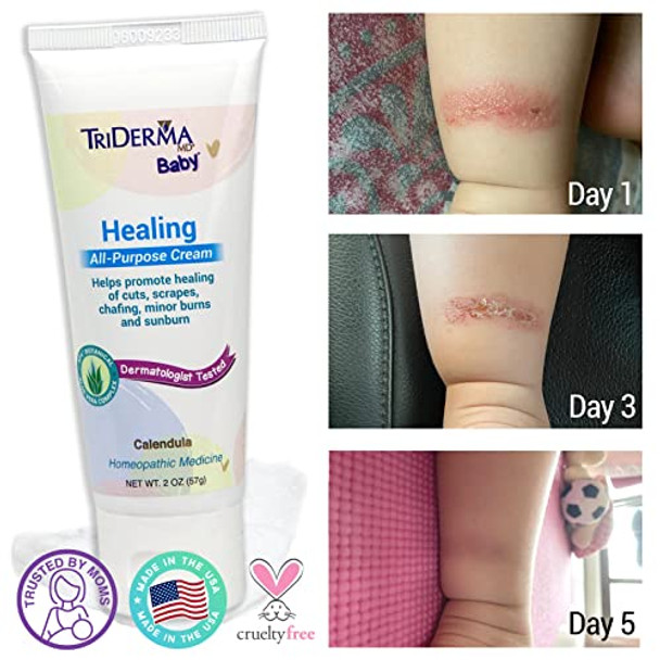 Triderma Baby All Purpose Healing Cream, Fsa Eligible For Chafing, Scrapes, Rashes, Dry Skin, Works Like A Non-Greasy Healing Ointment With Calendula And Ap4 Aloe Vera, 2 Oz