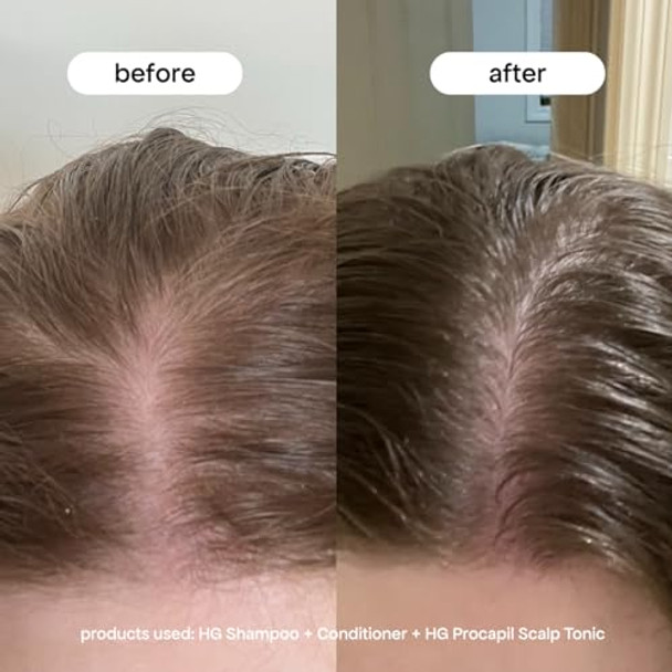 BONDIBOOST Procapil Scalp Treatment [4.23 fl oz], Daily Leave In Treatment for Thinning Hair + Anchor Hair, Scalp Serum for Thicker Hair with Procapil, Rosemary & Biotinoyl Tripeptide-1, Sulfate-