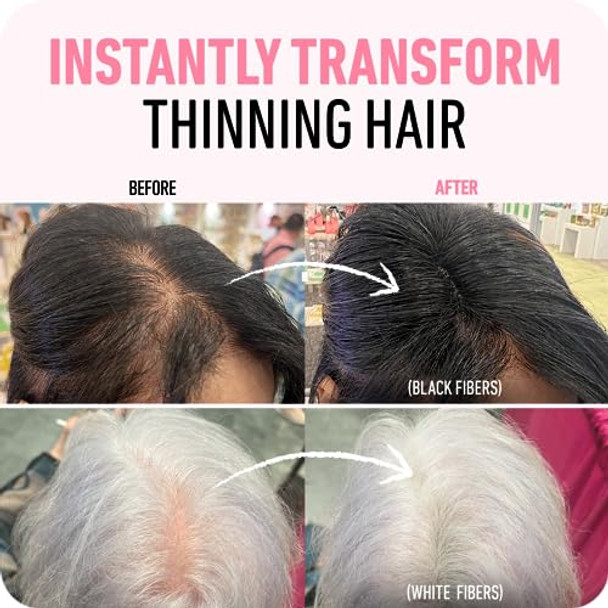 Boldify Hair Fibers (Dark Brown) Boldify Conceal & Glow Bundle: Undetectable & Natural + Biotin Gummies All Natural Vegan & Sugar  For Men & Women