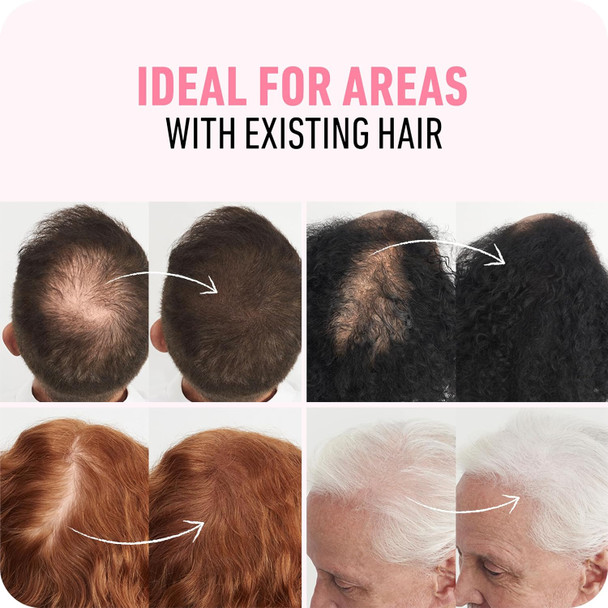 Boldify Hair Fibers (2 X 56G) - Fill In Thinning And Fine Hair For An Instantly Fuller Thicker Look - 14 Shades For Women & Men - Black