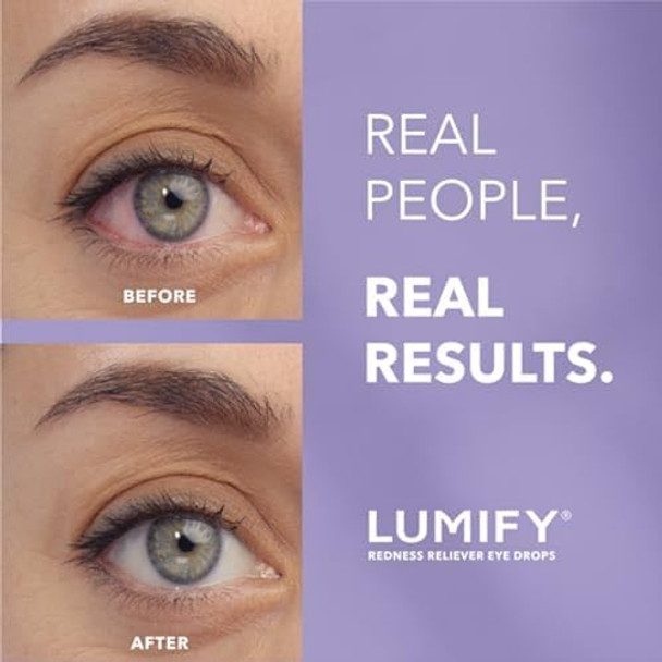 Lumify Eye Drops For Red Eyes Redness Reliever For Brighter Looking Eyes Works In 1 Minute & Lasts Up To 8 Hours Eye Drops 0.25 Fl Oz (7.5Ml) Lumify Eye Drops For Red Eyes Redness Reliever For Brighter Looking Eyes Works In 1 Minute & Lasts Up To 8 Hours Eye Drops 0.25 Fl Oz (7.5Ml)