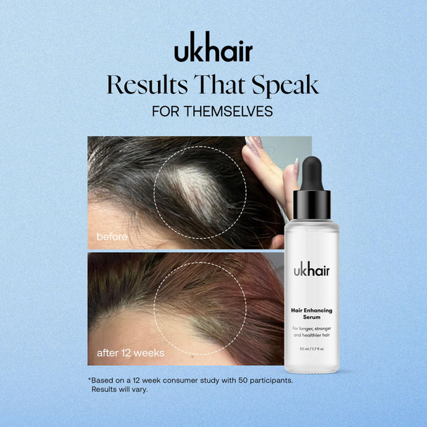 UKLASH Enhancing Hair Serum for Men and Women Promotes Thickness in Thinning Hair & Hair Loss Clinically Tested Lightweight & Fast-Absorbing